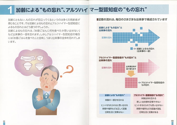 アルツハイマー型認知症