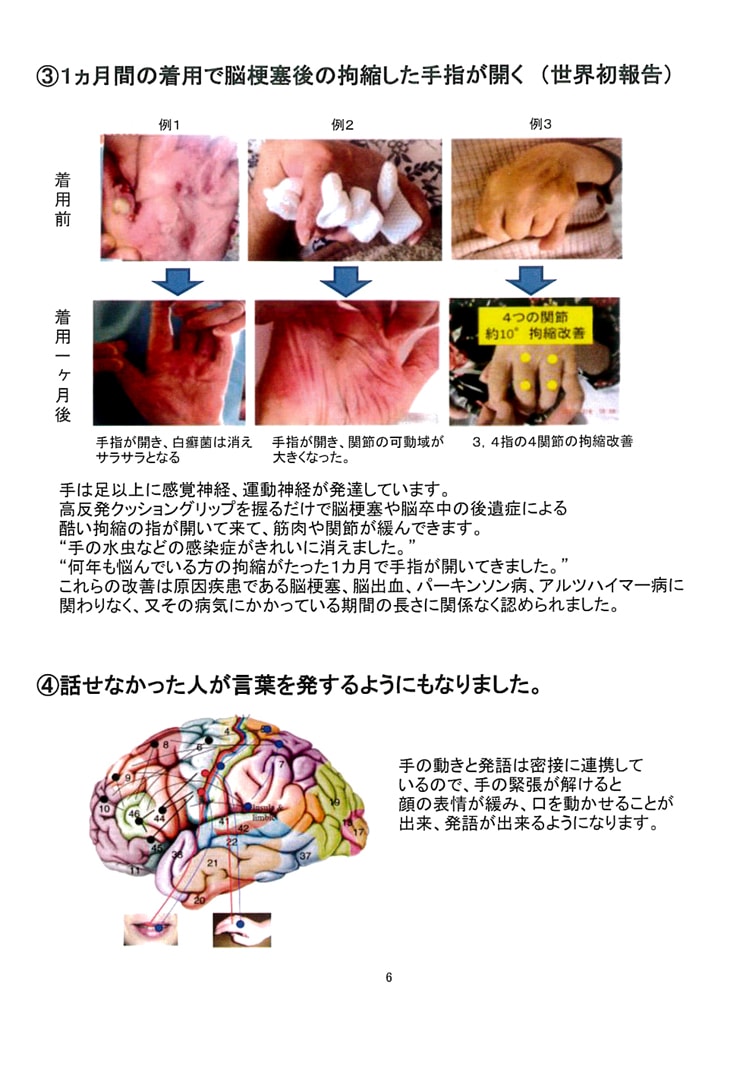 ナチュラルくらぶ ヤマダ薬局（NCY）では認知症改善に漢方と天然薬とともに手の運動療法も取り入れています